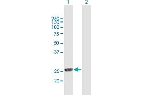 MPHOSPH8 Antikörper  (AA 1-259)