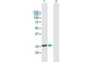 Western Blot analysis of MPHOSPH8 expression in transfected 293T cell line by MPHOSPH8 MaxPab polyclonal antibody. (MPHOSPH8 Antikörper  (AA 1-259))