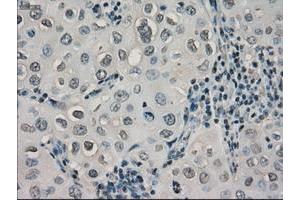 Image no. 7 for anti-Crystallin, alpha B (CRYAB) antibody (ABIN1497645) (CRYAB Antikörper)