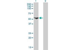 Western Blotting (WB) image for anti-Cytidine and DCMP Deaminase Domain Containing 1 (CDADC1) (AA 423-514) antibody (ABIN566468)