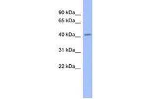 Image no. 1 for anti-Gastrulation Brain Homeo Box 2 (GBX2) (AA 179-228) antibody (ABIN6742290) (GBX2 Antikörper  (AA 179-228))