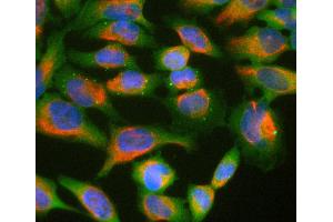 HeLa cell cultures stained with Ubiquilin 2 / UBQLN2 antibody (green) and chicken polyclonal antibody to vimentin (red). (Ubiquilin 2 Antikörper)