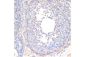 Immunohistochemistry of paraffin-embedded rat ovary using SM antibody (ABIN6128714, ABIN6148090, ABIN6148091 and ABIN6218232) at dilution of 1:200 (40x lens). (SMAD5 Antikörper  (AA 186-465))
