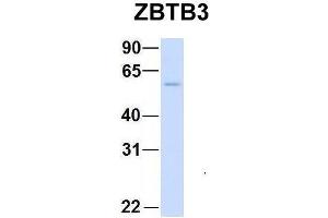 Host:  Rabbit  Target Name:  CHAD  Sample Type:  Human Adult Placenta  Antibody Dilution:  1. (ZBTB3 Antikörper  (Middle Region))