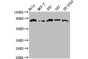 Western Blot Positive WB detected in: Hela whole cell lysate, MCF-7 whole cell lysate, 293 whole cell lysate, U87 whole cell lysate, SH-SY5Y whole cell lysate All lanes: BARD1 antibody at 3. (BARD1 Antikörper  (AA 428-777))