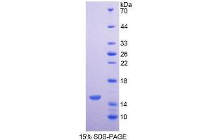 SDS-PAGE (SDS) image for Nitric Oxide Synthase 3 (Endothelial Cell) (NOS3) (AA 888-1001) protein (His tag) (ABIN1980854)