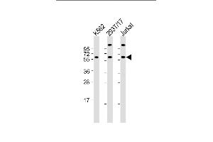 All lanes : Anti-Hsp 60 Antibody (N-term) at 1:2000 dilution Lane 1: K562 whole cell lysate Lane 2: 293T/17 whole cell lysate Lane 3: Jurkat whole cell lysate Lysates/proteins at 20 μg per lane. (HSPD1 Antikörper  (N-Term))