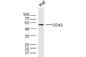 Raji cell lysates probed with CD43 Polyclonal Antibody, unconjugated  at 1:300 overnight at 4°C followed by a conjugated secondary antibody for 60 minutes at 37°C. (CD43 Antikörper  (AA 101-200))