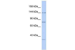 RNASEN antibody used at 1 ug/ml to detect target protein. (DROSHA Antikörper  (Middle Region))