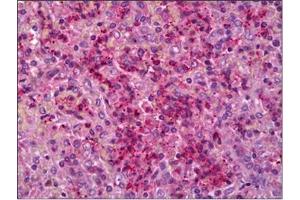 Human Spleen: Formalin-Fixed, Paraffin-Embedded (FFPE)