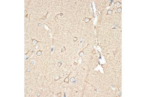 Immunohistochemistry of paraffin-embedded human brain using B Rabbit mAb (ABIN1680181, ABIN7101458, ABIN7101459 and ABIN7101460) at dilution of 1:100 (40x lens). (BCAP31 Antikörper)