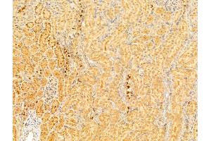 ABIN6264149 and ABIN6273012 at 1/100 staining Rat kidney tissue by IHC-P. (PEX16 Antikörper  (Internal Region))