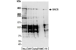 Western Blotting (WB) image for anti-Spastic Ataxia of Charlevoix-Saguenay (Sacsin) (SACS) (AA 175-225) antibody (ABIN7450705)