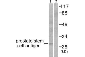 Western Blotting (WB) image for anti-Prostate Stem Cell Antigen (PSCA) (Internal Region) antibody (ABIN1848753) (PSCA Antikörper  (Internal Region))