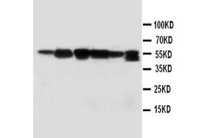 Anti-ABI1 antibody, Western blotting Lane 1: Rat Liver Tissue Lysate Lane 2: Rat Brain Tissue Lysate Lane 3: MM231 Cell Lysate Lane 4: HELA Cell Lysate Lane 5: SMMC Cell Lysate  Lane 6: JURKAT Cell Lysate (ABI1 Antikörper  (C-Term))