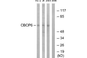 Western blot analysis of extracts from HeLa cells, Jurkat cells and A549 cells, using CBCP6 antibody. (AGBL4 Antikörper)