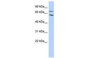 Image no. 1 for anti-Metastasis Associated 1 Family, Member 2 (MTA2) (AA 35-84) antibody (ABIN6740437) (MTA2 Antikörper  (AA 35-84))