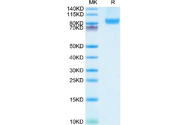 CD31 Protein (AA 28-601) (His tag)