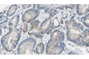 ABIN6269275 at 1/100 staining Human prostate tissue by IHC-P.