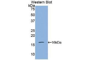 Western blot analysis of the recombinant protein. (VPREB1 Antikörper  (AA 43-134))