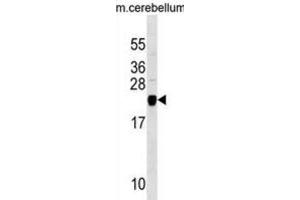 Western Blotting (WB) image for anti-Transgelin 3 (TAGLN3) antibody (ABIN3000208) (Transgelin 3 Antikörper)