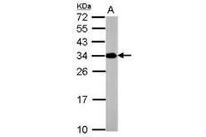 Image no. 1 for anti-ATPase, H+ Transporting, Lysosomal 31kDa, V1 Subunit E2 (ATP6V1E2) antibody (ABIN1502161) (ATP6V1E2 Antikörper)