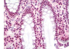 Anti-SSB / La antibody IHC staining of human colon. (SSB Antikörper)