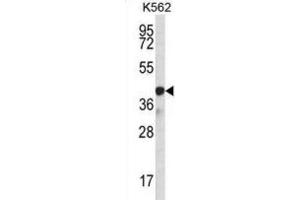 Western Blotting (WB) image for anti-Sp6 Transcription Factor (SP6) antibody (ABIN2997083)