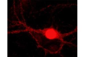 Indirect immunolabeling of cultured rat hippocampus neurons (dilution: 1 : 5000).
