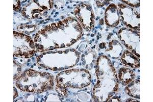 Immunohistochemical staining of paraffin-embedded Kidney tissue using anti-RIC8A mouse monoclonal antibody. (RIC8A Antikörper)
