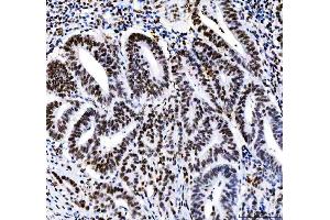 IHC analysis of HDAC2 using anti-HDAC2 antibody (ABIN7601564). (HDAC2 Antikörper  (AA 387-488))