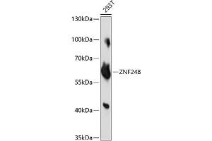 Western blot analysis of extracts of 293T cells, using ZNF248 antibody (ABIN7271470) at 1:1000 dilution. (ZNF248 Antikörper  (AA 1-110))
