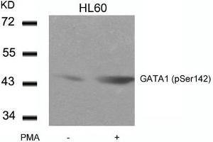 Western blot analysis of extracts from HL60 cells untreated or treated with PMA using GATA1(Phospho-Ser142) Antibody. (GATA1 Antikörper  (pSer142))