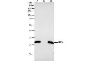 IP Image 14-3-3 sigma antibody immunoprecipitates SFN protein in IP experiments.
