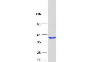 REEP2 Protein (Myc-DYKDDDDK Tag)