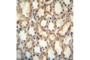 immunohistochemistry analysis in formalin fixed and paraffin embedded human kidney tissue reacted with KCNT2 / SLICK Antibody (C-term) followed by peroxidase conjugation of the secondary antibody and DAB staining. (KCNT2 Antikörper  (C-Term))