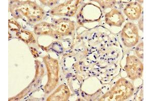 Immunohistochemistry of paraffin-embedded human kidney tissue using ABIN7152681 at dilution of 1:100 (FRMD5 Antikörper  (AA 295-504))