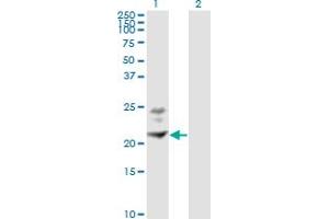 Western Blot analysis of BST2 expression in transfected 293T cell line by BST2 monoclonal antibody (M02), clone 3H4.