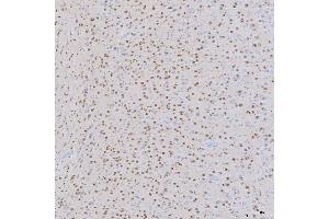 IHC analysis of SNRNP200 using anti-SNRNP200 antibody (ABIN7602032). (SNRNP200 Antikörper  (AA 557-2129))