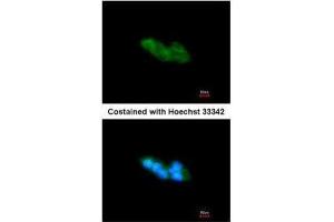 ICC/IF Image Immunofluorescence analysis of methanol-fixed HepG2, using ARMET, antibody at 1:200 dilution. (MANF Antikörper)