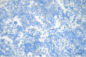 anti-Carbamoyl-Phosphate Synthase 1, Mitochondrial (CPS1) antibody