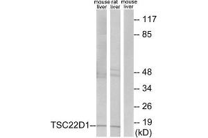 Western Blotting (WB) image for anti-TSC22 Domain Family, Member 1 (TSC22D1) (N-Term) antibody (ABIN1849646) (TSC22D1 Antikörper  (N-Term))