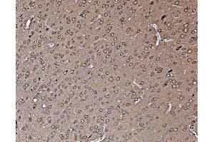 IHC analysis of Profilin 2/PFN2 using anti-Profilin 2/PFN2 antibody (ABIN7602692). (PFN2 Antikörper  (AA 96-138))