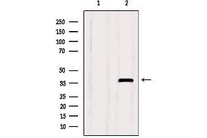 Western blot analysis of extracts from Myeloma cells, using SEPT9 Antibody. (Septin 9 Antikörper  (C-Term))