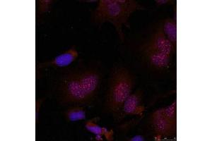 Immunofluorescence staining of methanol-fixed Hela cells using JunB(Phospho-Ser79) Antibody. (JunB Antikörper  (pSer79))