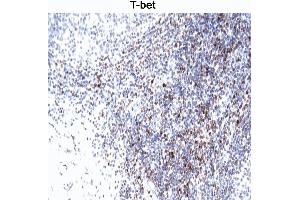 T-bet staining of human tonsil. (T-Bet Antikörper)