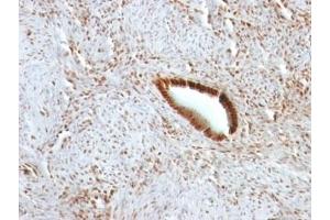 Formalin-fixed, paraffin-embedded human uterus stained with Nucleolin antibody.
