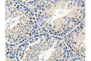 ABIN6266054 and ABIN6276599 at 1/100 staining Mouse testis tissue by IHC-P.