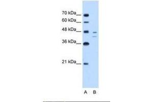 Image no. 2 for anti-Fumarylacetoacetate Hydrolase (Fumarylacetoacetase) (FAH) (AA 311-360) antibody (ABIN320667)
