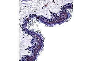 Tyrosinase Antibody immunohistochemistry analysis in formalin fixed and paraffin embedded human skin tissue followed by peroxidase conjugation of the secondary antibody and DAB staining. (TYR Antikörper  (C-Term))